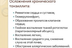 Осложнения хронического тонзиллита