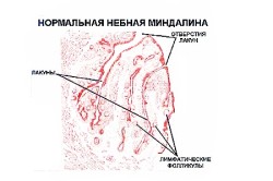 Строение небной миндалины 