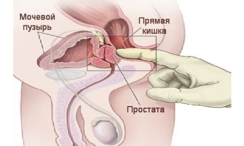 Расположение предстательной железы