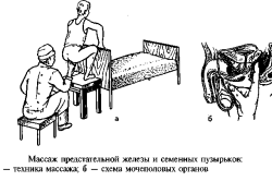 Массаж предстательной железы