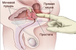 Принцип массажа простаты