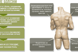 Течение простатита и его симптомы