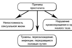 Причины простатита